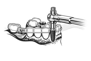 guidata1