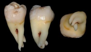 molari4